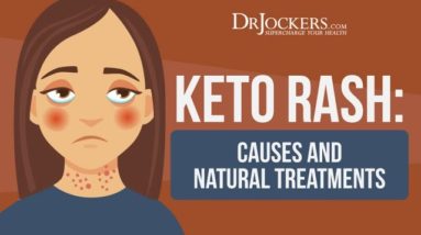 Keto Rash: Causes and Natural Treatments